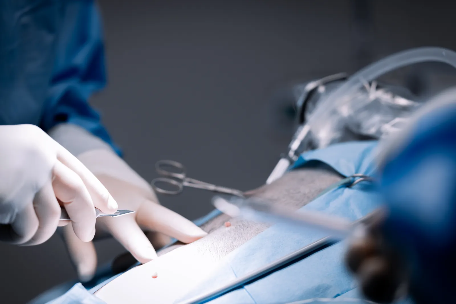 Chirurgin bereitet die laparoskopischen Instrumente auf dem sterilen Tuch vor